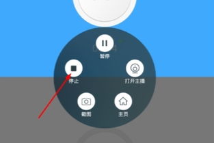 全民K歌如何录屏，安卓手机全民k歌怎么录屏