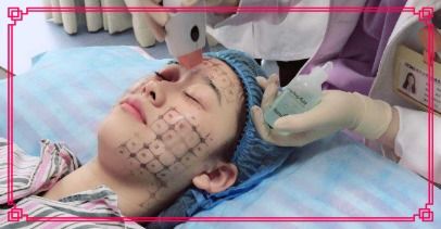 叫性化性的作用及注意事项，怎样才能化性