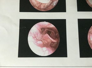 唱歌会把嗓子唱坏吗，如何知道自己声带坏了