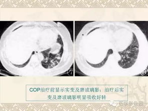 善人讲叫性好病案例，叫性化性治好病的案例